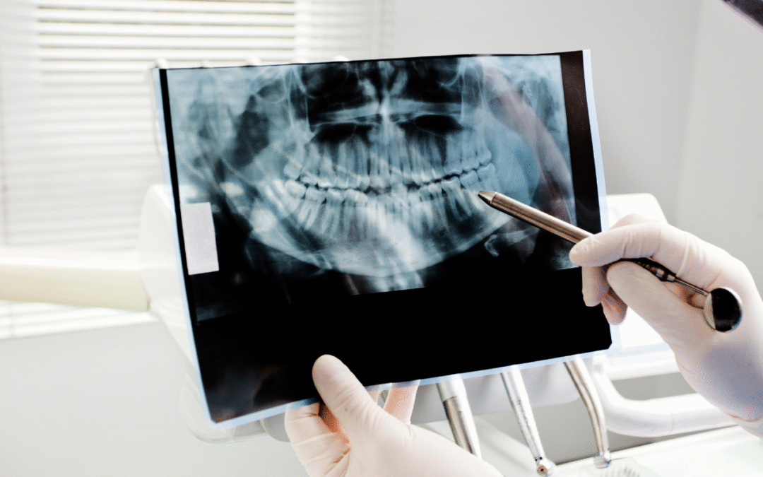 Are Dental X-rays Safe for Children? What Parents Need to Know About Radiation