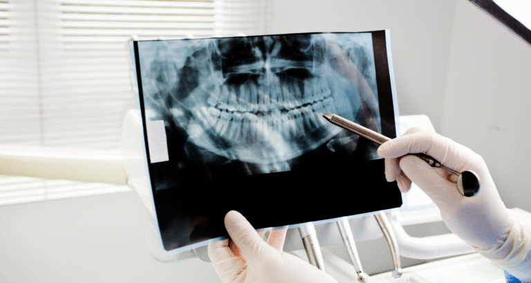 Paediatric Dental X-rays Safety Melbourne | DENTL Children