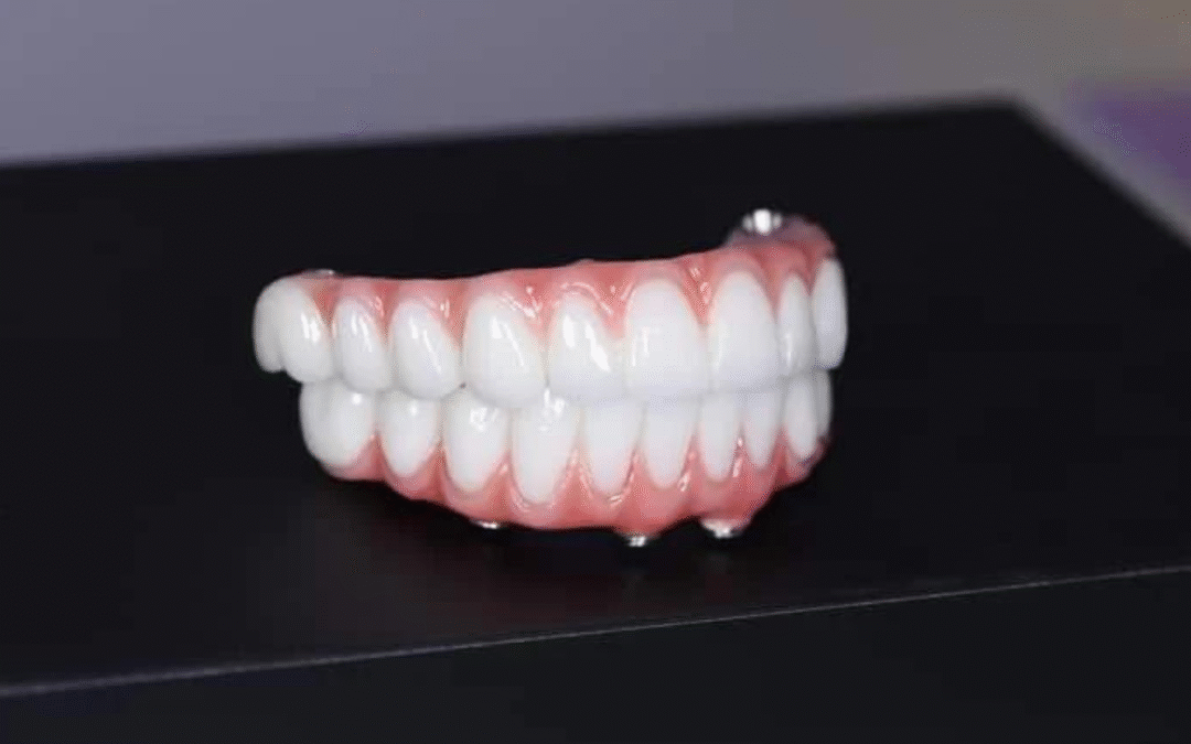 Denture to All-Teeth-On-Four: Replacement Options