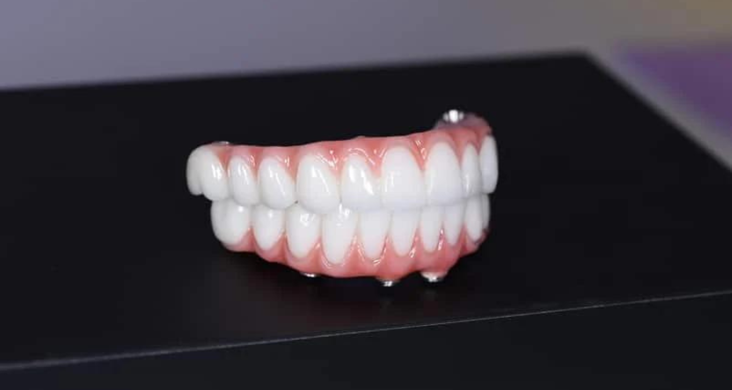 Beyond Dentures Fixed Full Arch Teeth With All-on-4 Plus® Technology Denture Replacement Options: to All-Teeth-On-Four in Melbourne