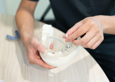Understanding Recovery Times for Dental Implants