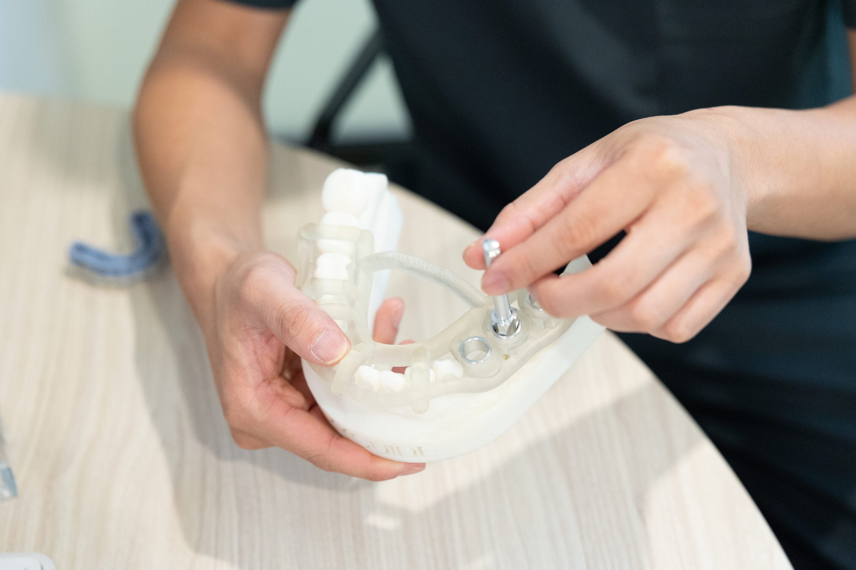 Dental Implant Recovery East Melbourne