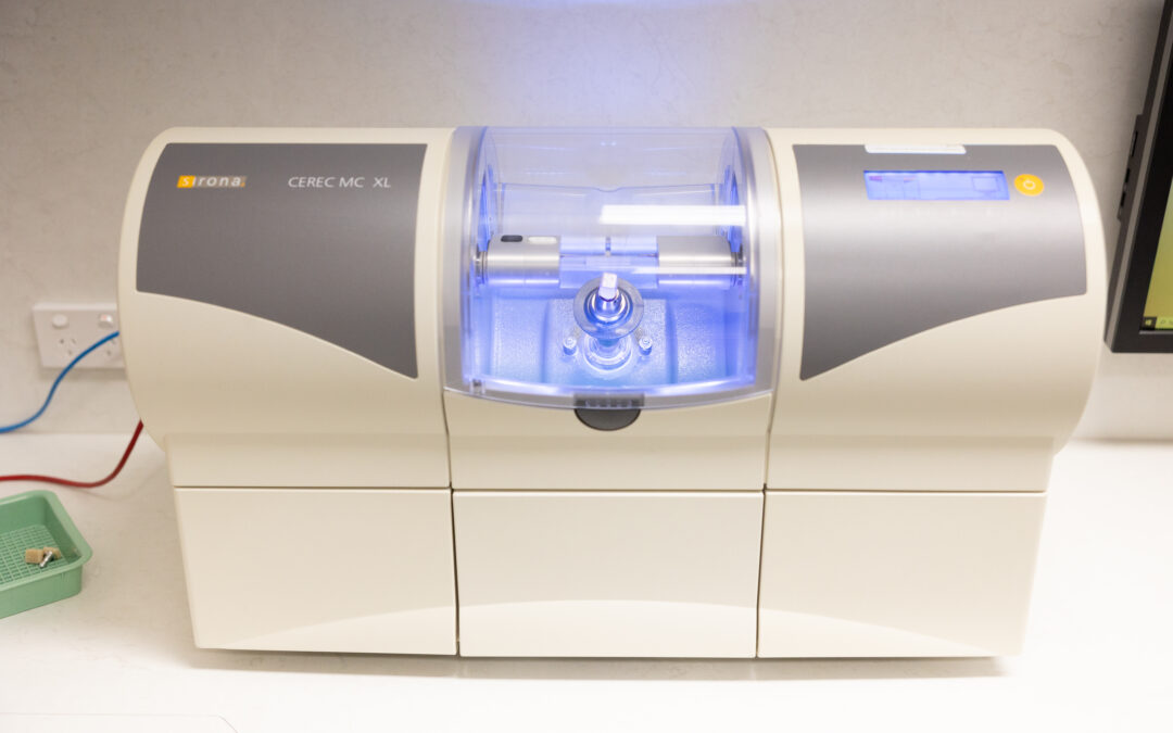 Lab Crown or CEREC Crown: What Is the Difference?