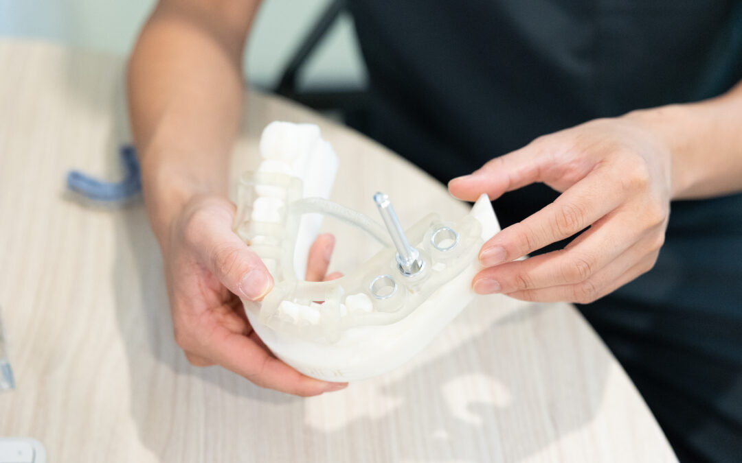 Replace a Missing Tooth With Dental Implants