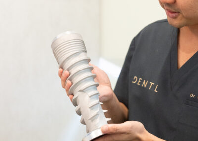 How Much Do Dental Implants Cost in East Melbourne?